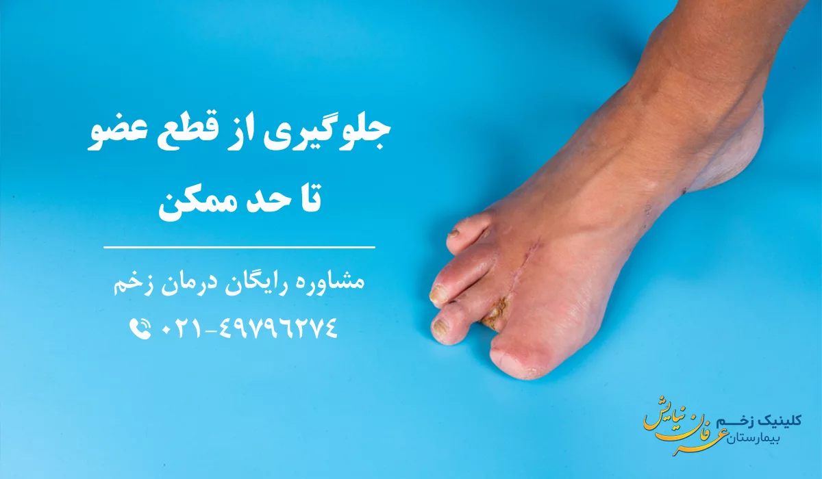 اهداف درمانی بهترین کلینیک درمان زخم