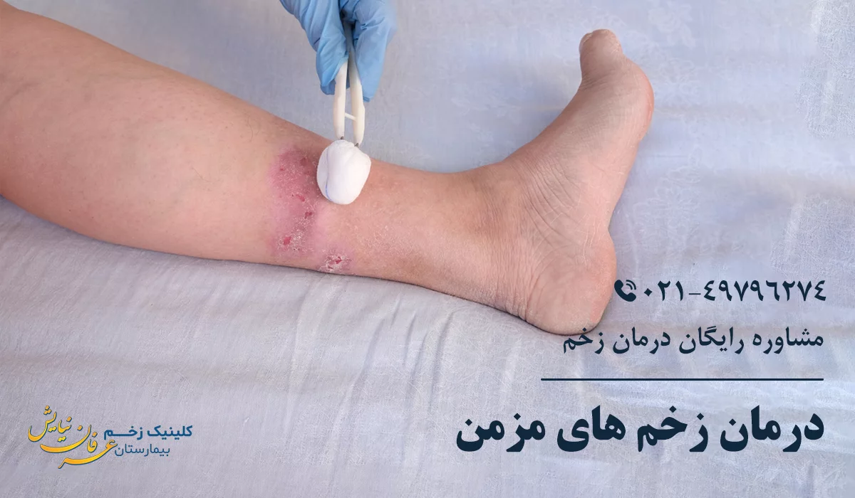 بهترین کلینیک درمان زخم