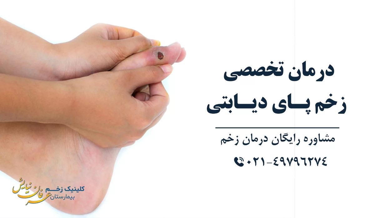 بهترین کلینیک درمان زخم زخم دیابتی