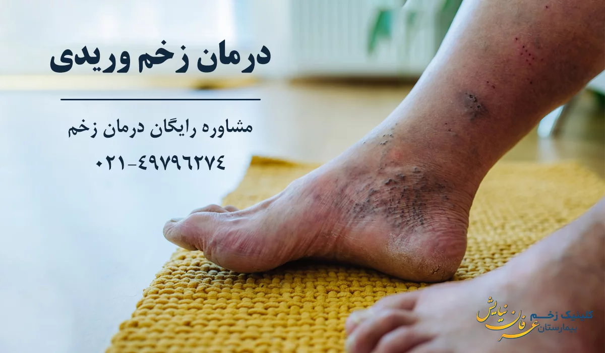 بهترین کلینیک درمان زخم وریدی