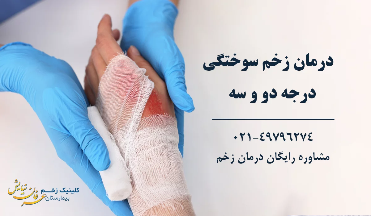 بهترین کلینیک درمان زخم سوختگی