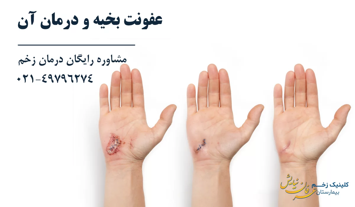 بهترین کلینیک درمان زخم جراحی