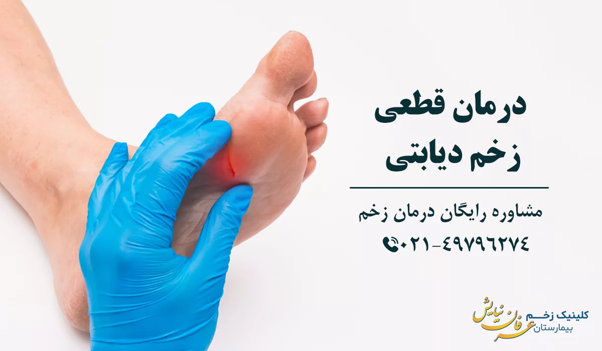 درمان قطعی زخم دیابتی
