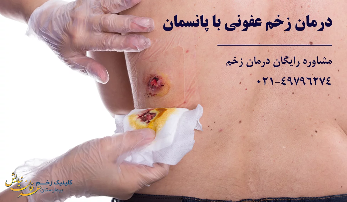 درمان عفونت زخم با پانسمان