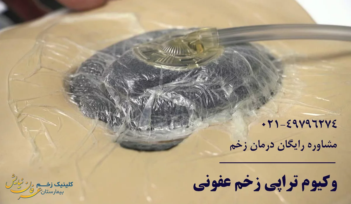 وکیوم تراپی زخم عفونی