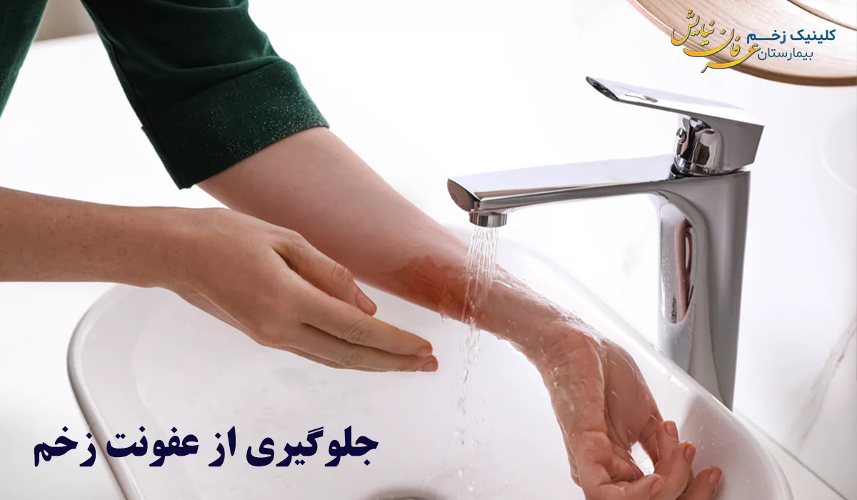 پیشگیری از عفونت زخم