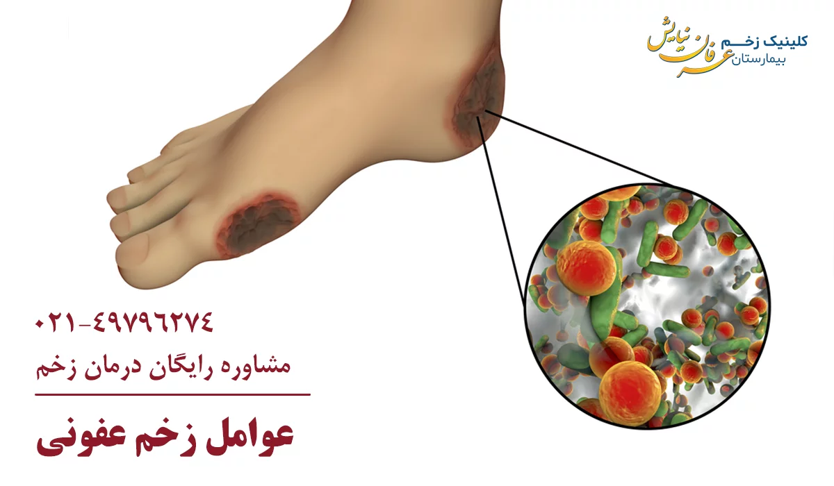 عوامل زخم عفونی