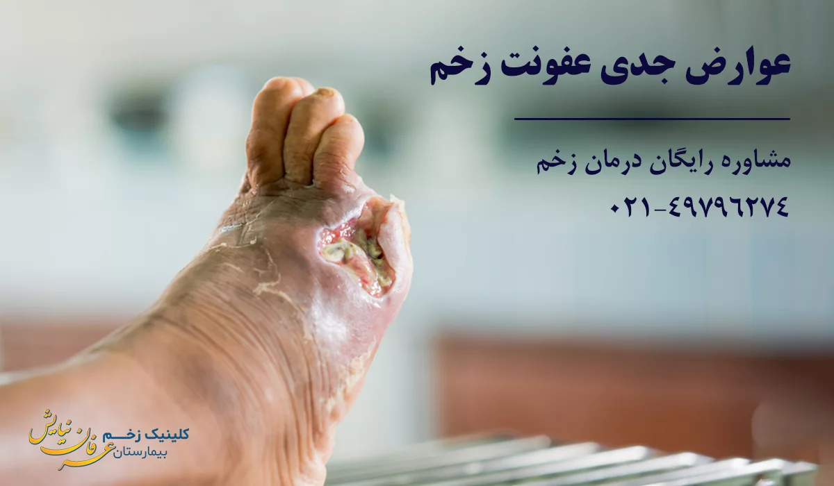 عوارض عدم درمان زخم عفونی