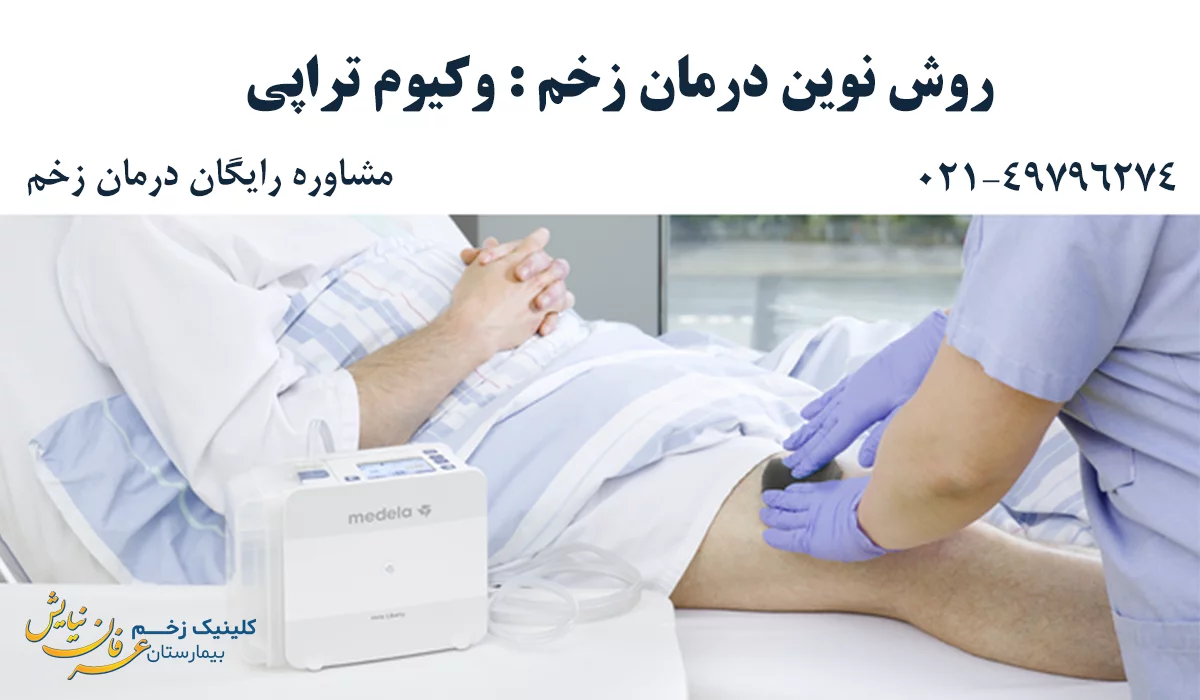 وکیوم تراپی زخم