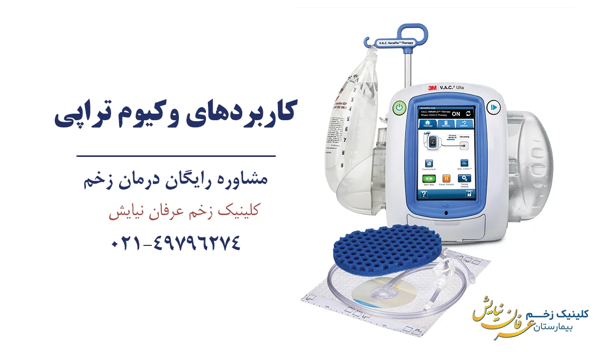کاربردهای وکیوم تراپی زخم