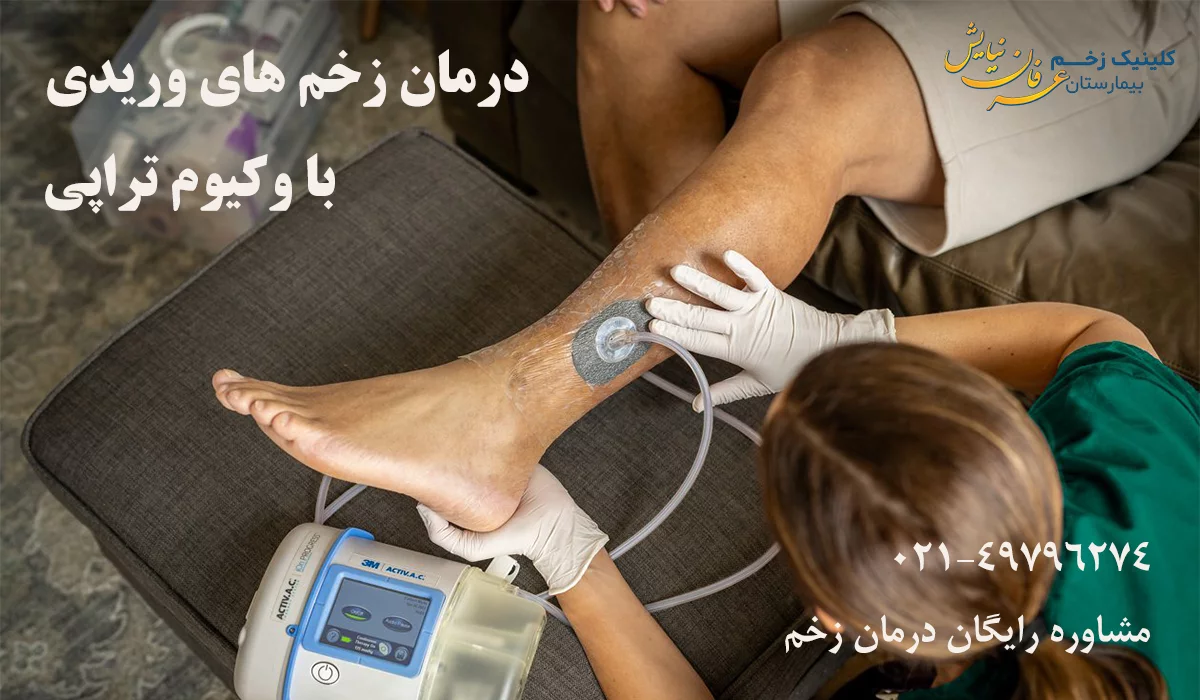 وکیوم تراپی زخم وریدی