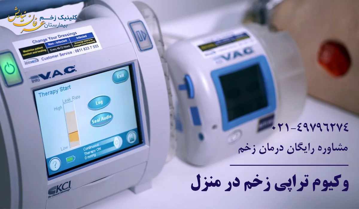 وکیوم تراپی زخم در منزل