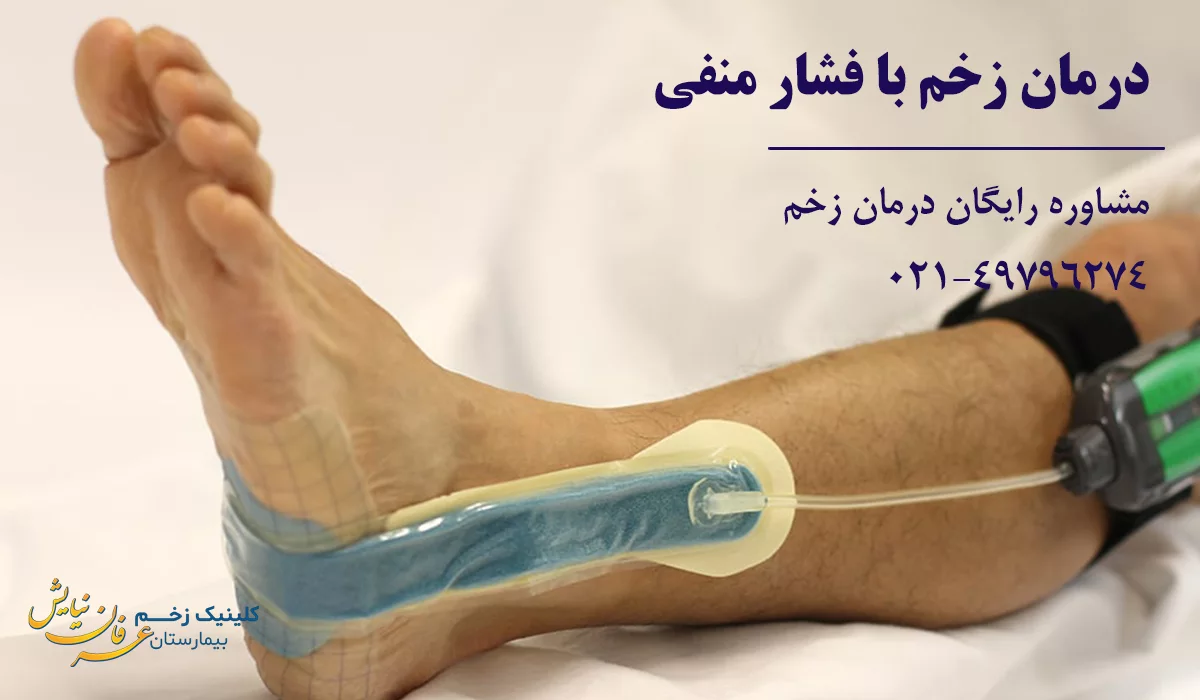 درمان زخم با فشار منفی