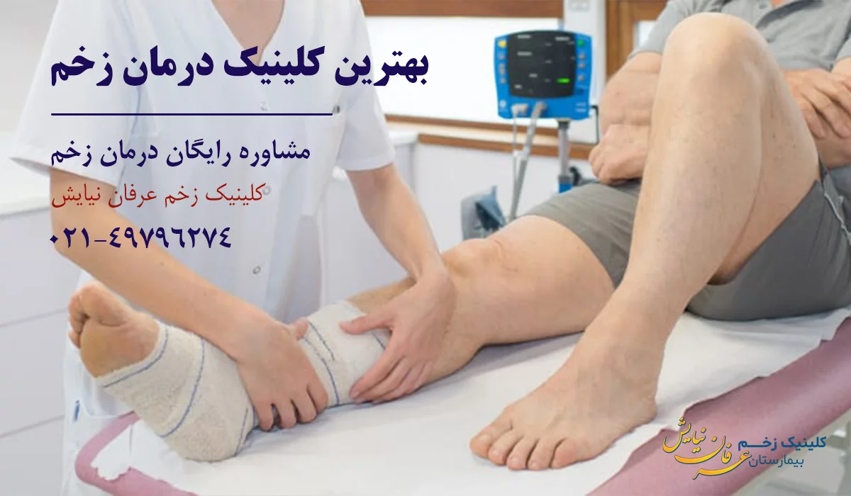 بهترین کلینیک وکیوم تراپی زخم