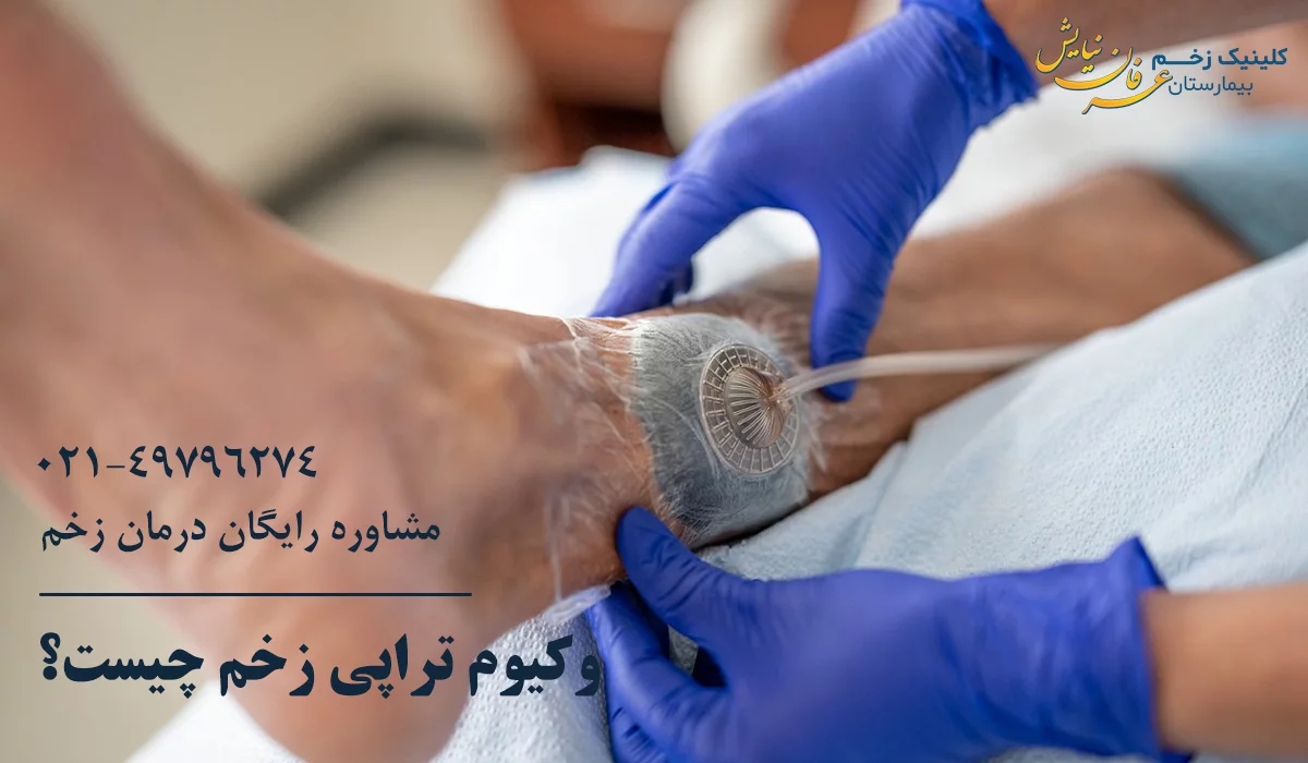 وکیوم تراپی زخم