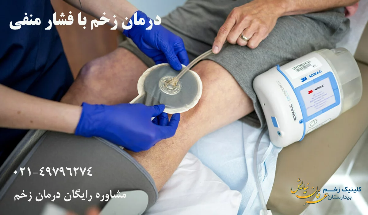 درمان زخم با فشار منفی