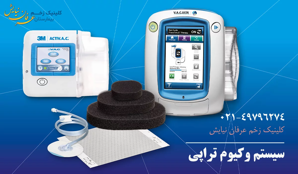 اجزاء وکیوم تراپی زخم