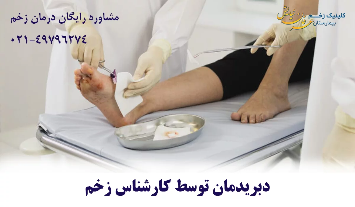 دبریدمان زخم توسط کارشناس زخم