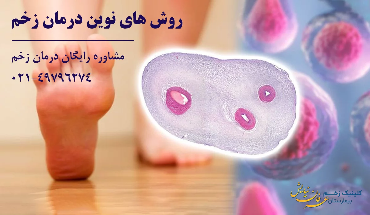روش های بهترین کارشناس زخم