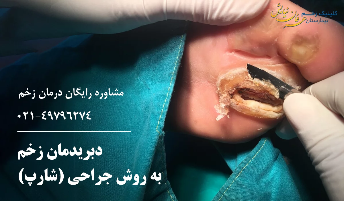 دبریدمان زخم جراحی