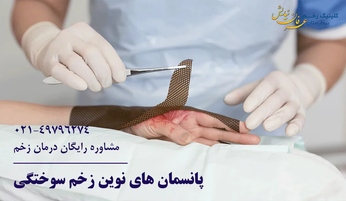 پانسمان زخم سوختگی