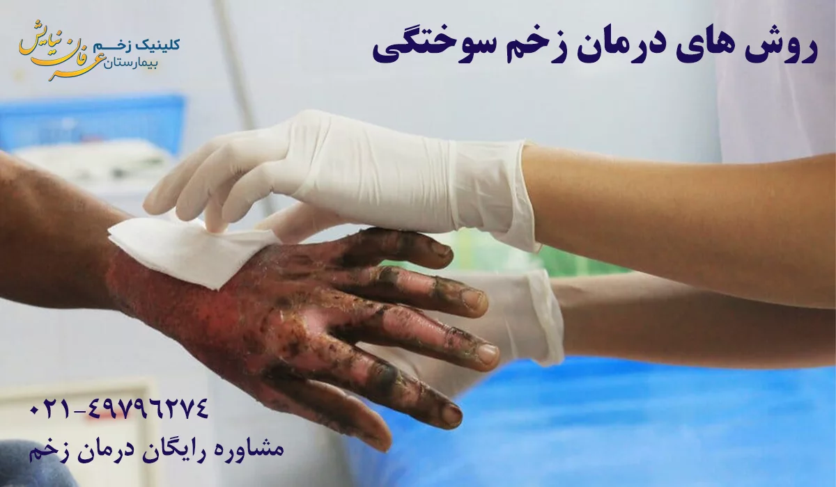روش های درمان زخم سوختگی